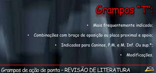 • Mais frequentemente indicado; 
• Combinações com braço de oposição ou placa proximal e apoio; 
• Indicados para Caninos, P.M. e M. Inf. Ou sup.*; 
• Modificações. 
 