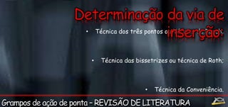 • Técnica dos três pontos ou Técnica de Roach; 
• Técnica das bissetrizes ou técnica de Roth; 
• Técnica da Conveniência. 
 