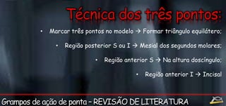 • Marcar três pontos no modelo  Formar triângulo equilátero; 
• Região posterior S ou I  Mesial dos segundos molares; 
• Região anterior S  Na altura doscíngulo; 
• Região anterior I  Incisal 
 