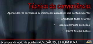 • Apenas dentes anteriores ou inclinações excessivas dos dentes suportes; 
• Analisadas todas as áreas; 
• Reposicionamento do modelo; 
• Haste fixa no modelo. 
 