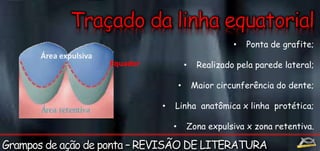• Ponta de grafite; 
• Realizado pela parede lateral; 
• Maior circunferência do dente; 
• Linha anatômica x linha protética; 
• Zona expulsiva x zona retentiva. 
Área expulsiva 
Equador 
 
