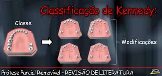 Classe 
III 
Modificações 
 