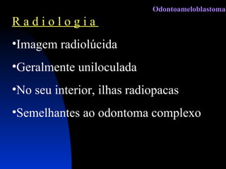 R a d i o l o g i a  Imagem radiolúcida Geralmente uniloculada No seu interior, ilhas radiopacas Semelhantes ao odontoma complexo Odontoameloblastoma 