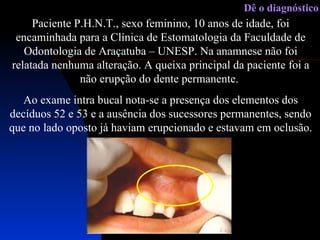 Paciente P.H.N.T., sexo feminino, 10 anos de idade, foi encaminhada para a Clínica de Estomatologia da Faculdade de Odontologia de Araçatuba – UNESP. Na anamnese não foi relatada nenhuma alteração. A queixa principal da paciente foi a não erupção do dente permanente.  Ao exame intra bucal nota-se a presença dos elementos dos decíduos 52 e 53 e a ausência dos sucessores permanentes, sendo que no lado oposto já haviam erupcionado e estavam em oclusão. Dê o diagnóstico 