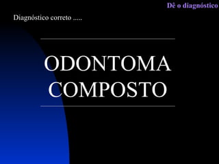 ODONTOMA COMPOSTO Diagnóstico correto ..... Dê o diagnóstico 