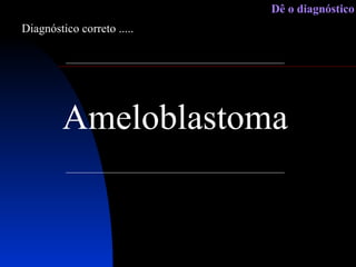 Ameloblastoma Diagnóstico correto ..... Dê o diagnóstico 