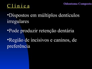 C l í n i c a Dispostos em múltiplos dentículos irregulares Pode produzir retenção dentária Região de incisivos e caninos, de preferência Odontoma Composto 