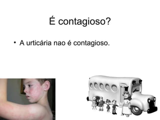 É contagioso?

• A urticária nao é contagioso.
 