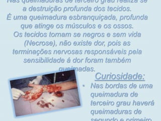 Nas queimaduras de terceiro grau realiza se
      a destruição profunda dos tecidos.
É uma queimadura esbranquiçada, profunda
     que atinge os músculos e os ossos.
  Os tecidos tornam se negros e sem vida
      (Necrose), não existe dor, pois as
  terminações nervosas responsáveis pela
      sensibilidade á dor foram também
                 queimadas.
                          Curiosidade:
                       • Nas bordas de uma
                         queimadura de
                         terceiro grau haverá
                         queimaduras de
 