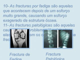 10- As fracturas por fadiga são aquelas
que acontecem depois de um esforço
muito grande, causando um esforço
exagerado da estrutura óssea.
11- As fracturas patológicas são aquelas
causadas por problemas já existentes,
elas enfraquecem os ossos e causa uma
fractura.


   Fractura de         Fractura
 