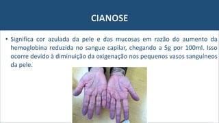 Semiologia: Cianose, tosse e dispneia | PPTX
