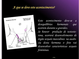 Este acontecimento deve-se a
desequilíbrios   hormonais      que
ocorrem durante a gravidez.
Se houver produção de testoste-
rona, ocorrerá desenvolvimento de
órgão sexuais masculinos na ausên-
cia desta hormona o feto vai
desenvolver características sexuais
femininas.

             2009
 
