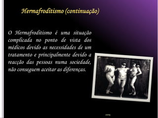 O Hermafroditismo é uma situação
complicada no ponto de vista dos
médicos devido as necessidades de um
tratamento e principalmente devido a
reacção das pessoas numa sociedade,
não conseguem aceitar as diferenças.




                                       2009
 