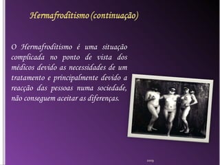 O Hermafroditismo é uma situação complicada no ponto de vista dos médicos devido as necessidades de um tratamento e principalmente devido a reacção das pessoas numa sociedade, não conseguem aceitar as diferenças.  2009 