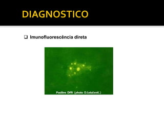  Imunofluorescência direta
 