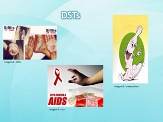 Imagem 1.-sifilis




                                     Imagem 2- preservativo




                    Imagem 3- sida
 