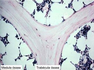 Trabécula óssea
Medula óssea
 