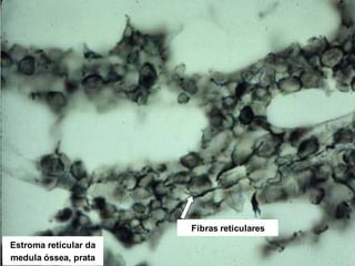 Estroma reticular da
medula óssea, prata
Fibras reticulares
 