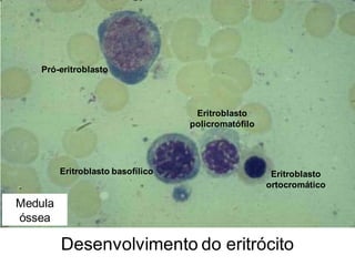 Desenvolvimento do eritrócito
Pró-eritroblasto
Eritroblasto basofílico
Eritroblasto
policromatófilo
Eritroblasto
ortocromático
Medula
óssea
 