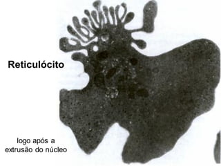 Reticulócito
logo após a
extrusão do núcleo
 