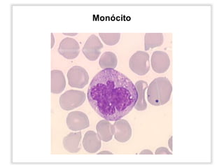 Monócito
 
