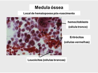 Medula óssea
Local de hematopoese pós-nascimento
hemocitoblasto
(célula tronco)
Eritrócitos
(células vermelhas)
Leucócitos (células brancas)
 