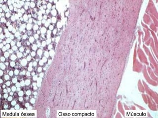 Medula óssea Osso compacto Músculo
 