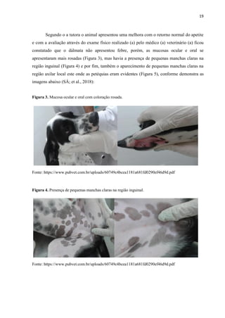 19
Segundo o a tutora o animal apresentou uma melhora com o retorno normal do apetite
e com a avaliação através do exame físico realizado (a) pelo médico (a) veterinário (a) ficou
constatado que o dálmata não apresentou febre, porém, as mucosas ocular e oral se
apresentaram mais rosadas (Figura 3), mas havia a presença de pequenas manchas claras na
região inguinal (Figura 4) e por fim, também o aparecimento de pequenas manchas claras na
região axilar local este onde as petéquias eram evidentes (Figura 5), conforme demonstra as
imagens abaixo (SÁ; et al., 2018):
Figura 3. Mucosa ocular e oral com coloração rosada.
Fonte: https://www.pubvet.com.br/uploads/60749c4bcea1181a681fd0290ef46d9d.pdf
Figura 4. Presença de pequenas manchas claras na região inguinal.
Fonte: https://www.pubvet.com.br/uploads/60749c4bcea1181a681fd0290ef46d9d.pdf
 