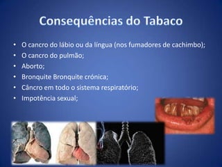 • O cancro do lábio ou da língua (nos fumadores de cachimbo);
• O cancro do pulmão;
• Aborto;
• Bronquite Bronquite crónica;
• Câncro em todo o sistema respiratório;
• Impotência sexual;
 