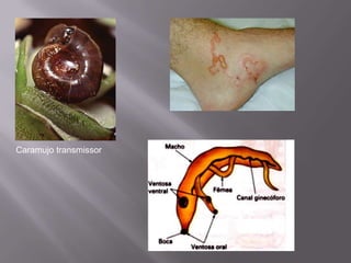 Caramujo transmissor