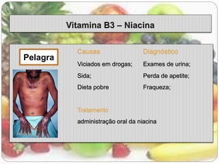 Causas Diagnóstico 
Viciados em drogas; Exames de urina; 
Sida; Perda de apetite; 
Dieta pobre Fraqueza; 
Tratamento 
administração oral da niacina 
Pelagra 
 