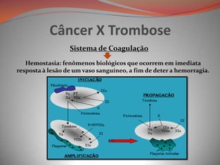 Câncer X Trombose
Sistema de Coagulação
Hemostasia: fenômenos biológicos que ocorrem em imediata
resposta à lesão de um vaso sanguíneo, a fim de deter a hemorragia.
 