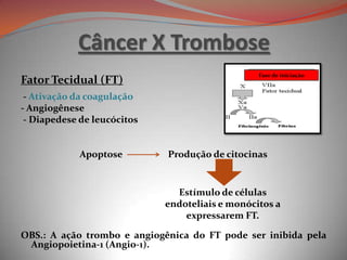 Câncer X Trombose
Fator Tecidual (FT)
- Ativação da coagulação
- Angiogênese
- Diapedese de leucócitos
Apoptose Produção de citocinas
OBS.: A ação trombo e angiogênica do FT pode ser inibida pela
Angiopoietina-1 (Angio-1).
Estímulo de células
endoteliais e monócitos a
expressarem FT.
Fase de iniciação
 
