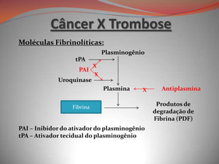 Moléculas Fibrinolíticas:
PAI – Inibidor do ativador do plasminogênio
tPA – Ativador tecidual do plasminogênio
Fibrina
Plasminogênio
Plasmina
tPA
PAI
Antiplasmina
Produtos de
degradação de
Fibrina (PDF)
X
X
Uroquinase
X
Câncer X Trombose
 