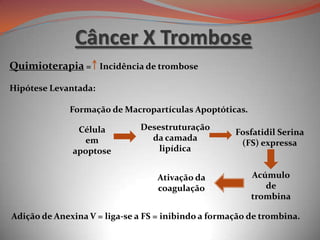 Quimioterapia = Incidência de trombose
Hipótese Levantada:
Formação de Macropartículas Apoptóticas.
Adição de Anexina V = liga-se a FS = inibindo a formação de trombina.
Célula
em
apoptose
Desestruturação
da camada
lipídica
Fosfatidil Serina
(FS) expressa
Ativação da
coagulação
Acúmulo
de
trombina
Câncer X Trombose
 
