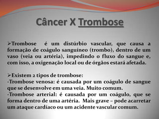 Câncer X Trombose
Trombose é um distúrbio vascular, que causa a
formação de coágulo sanguíneo (trombo), dentro de um
vaso (veia ou artéria), impedindo o fluxo do sangue e,
com isso, a oxigenação local ou de órgãos estará afetada.
Existem 2 tipos de trombose:
-Trombose venosa: é causada por um coágulo de sangue
que se desenvolve em uma veia. Muito comum.
-Trombose arterial: é causada por um coágulo, que se
forma dentro de uma artéria. Mais grave – pode acarretar
um ataque cardíaco ou um acidente vascular comum.
 