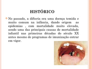 HISTÓRICO


No passado, a difteria era uma doença temida e
muito comum na infância, dando origem as
epidemias , com mortalidade muito elevada,
sendo uma das principais causas de mortalidade
infantil nas primeiras décadas do século XX
antes mesmo de programas de imunização entrar
em vigor.

 