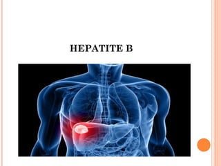 HEPATITE B

 