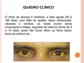 QUADRO CLÍNICO
O início da doença é insidioso, a fase aguda (45 a
180 dias); com falta de apetite, dores abdominais,
náuseas e vômitos; as vezes ocorre dores
musculares e fadiga, seguidas de icterícia (inicio de 5
a 10 dias), pode não haver febre ou febre baixa;
torna-se crônica etc...

 