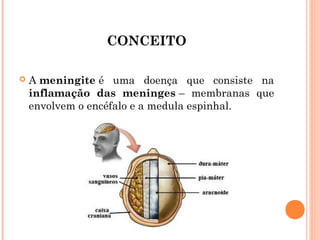 CONCEITO


A meningite é uma doença que consiste na
inflamação das meninges – membranas que
envolvem o encéfalo e a medula espinhal. 

 