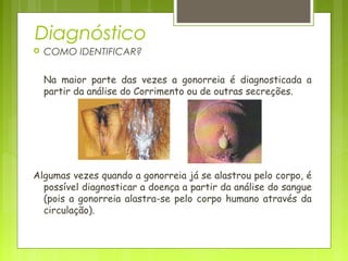 Diagnóstico 
 COMO IDENTIFICAR? 
Na maior parte das vezes a gonorreia é diagnosticada a 
partir da análise do Corrimento ou de outras secreções. 
Algumas vezes quando a gonorreia já se alastrou pelo corpo, é 
possível diagnosticar a doença a partir da análise do sangue 
(pois a gonorreia alastra-se pelo corpo humano através da 
circulação). 
 