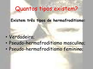 Quantos tipos existem? Existem três tipos de hermafroditismo:Verdadeiro;Pseudo-hermafroditismomasculino;Pseudo-hermafroditismofeminino;