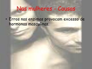 Nas mulheres - CausasErros nas enzimas provocam excesso de hormonas masculinas. 