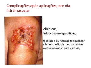 Complicações após aplicações, por via
intramuscular
Abcessos;
Infecções inespecíficas;
Ulceração ou necrose tecidual por
administração de medicamentos
contra indicados para esta via;
 