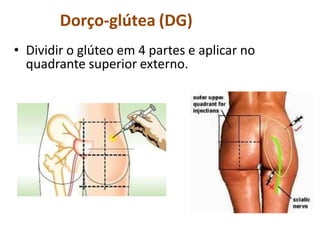 Dorço-glútea (DG)
• Dividir o glúteo em 4 partes e aplicar no
quadrante superior externo.
 