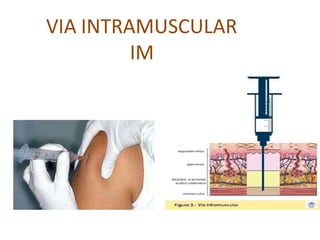 VIA INTRAMUSCULAR
IM
 
