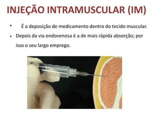 INJEÇÃO INTRAMUSCULAR (IM)
•
•
É a deposição de medicamento dentro do tecido muscular.
Depois da via endovenosa é a de mais rápida absorção; por
isso o seu largo emprego.
 