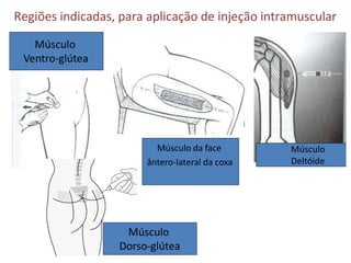 Músculo
Deltóide
Músculo da face
ântero-lateral da coxa
Músculo
Ventro-glútea
Músculo
Dorso-glútea
Regiões indicadas, para aplicação de injeção intramuscular
 