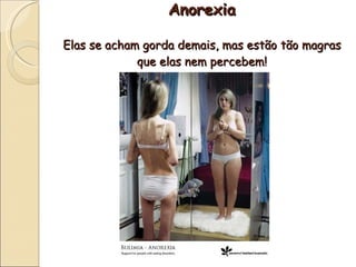Anorexia

Elas se acham gorda demais, mas estão tão magras
             que elas nem percebem!
 