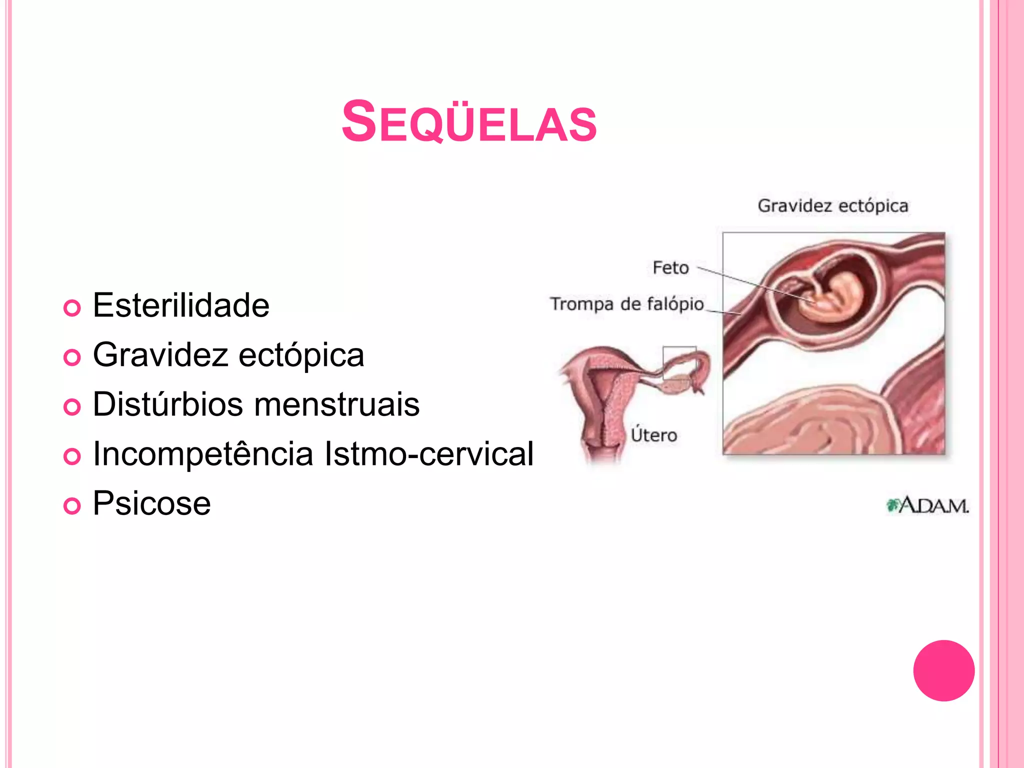 SEQÜELAS
 Esterilidade
 Gravidez ectópica
 Distúrbios menstruais
 Incompetência Istmo-cervical
 Psicose
 